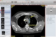 Escape Medical Viewer For Mac 4.4.3 正式版